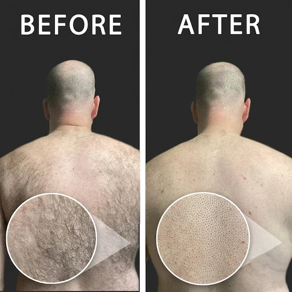 Rasoir Dos Homme pour une Peau Lisse Sans Effort